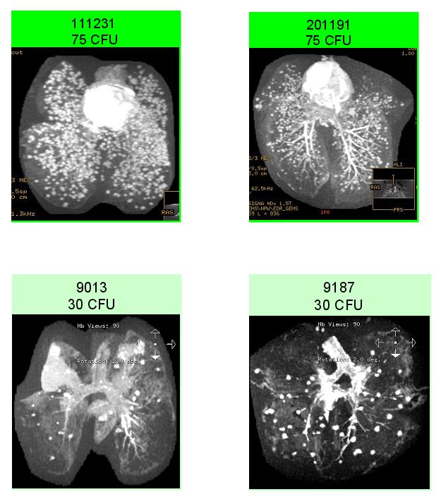 MRI scans of the lungs of unvaccinated animals (two per dose level) given two different doses – 75 colony forming units (CFU) or 30 CFU – of the bacterium M. tuberculosis. It can be seen that the two animals housed together show the same level of disease pathology and that this is dependent upon the initial dose given rather than any cross-infection.