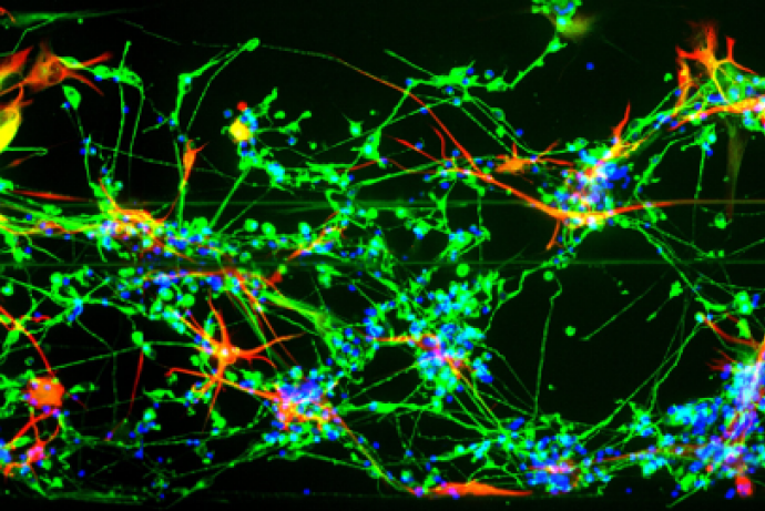 co-culture of iPSC derived neurons and astrocytes