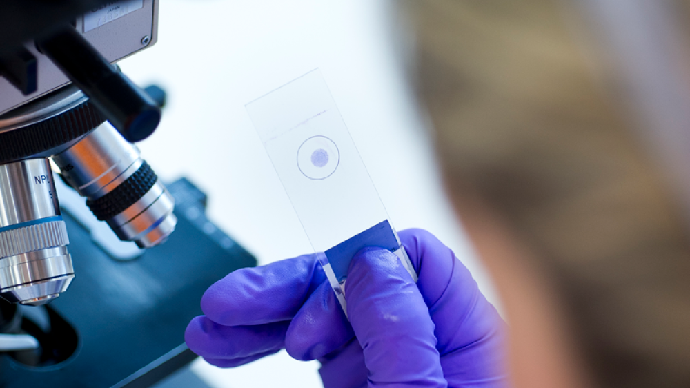 a photo showing a glass slide being held by a scientist, near to a microscope