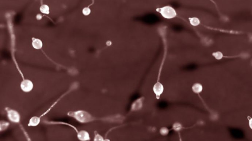 Dictyostelium under a microscope