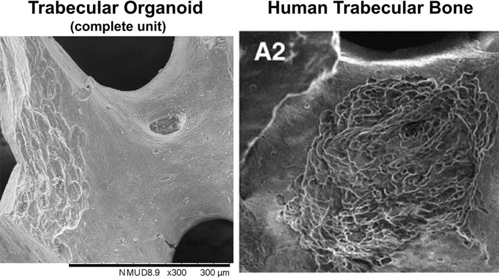 The resorption patterns in the trabecular organoid containing both osteoblasts and osteoclasts