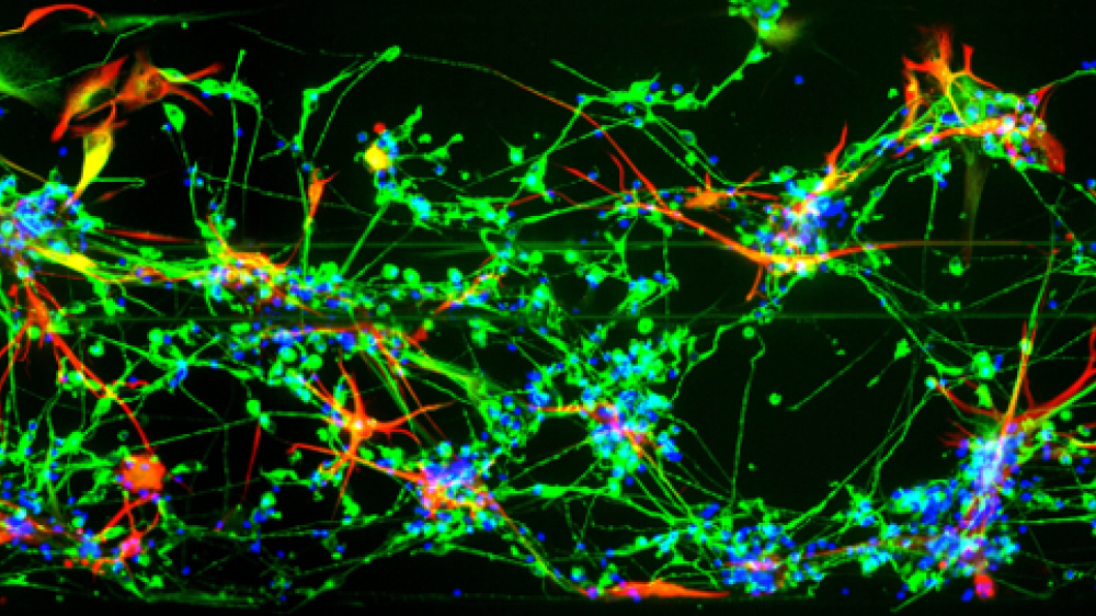 Decorative image of neurons and astrocytes