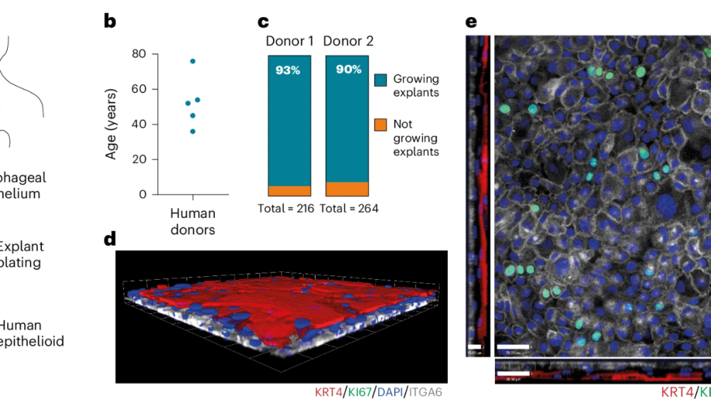 Figure: the establishment and characterisation of human oesophageal epithelial explants (a) Experimental workflow schematic: oesophageal epithelium is isolated from human donors, plated, and forms a human epithelioid (b) Dot plot of human donors ages - young (late 20s) to elderly (late 70s) (c) Bar chart showing high explant growth efficiency from two donors (93% and 90%) (d) 3D confocal image of cultured epithelial explants showing stratified epithelial structure.(e) Confocal image showing dense epithelial