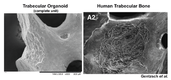 The resorption patterns in the trabecular organoid containing both osteoblasts and osteoclasts 