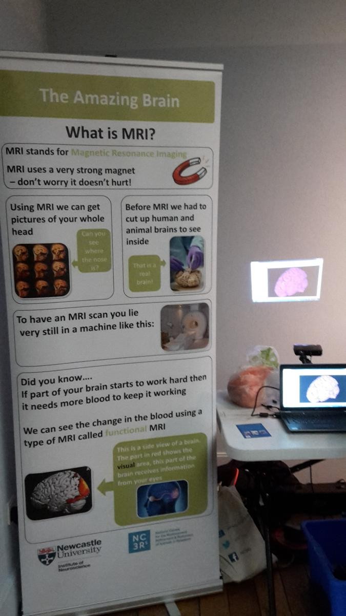 A banner stand showing information on the amazing brain, what is MRI?