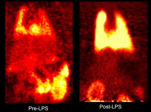 Shows how [11C]PBR28 PET imaging- sensitive to inflammatory cells- can be used as  a powerful tool for imaging the distribution of inflammation in the lung of a rat after inhalation of a lipopolysacchardie (LPS) challenge non-invasvively and on more than a single occasion, allowing effects of a drug to be assessed with just a single animal imaged at multiple times
