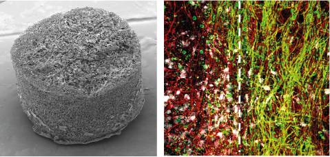 The left panel shows a scanning electron microscope image of a cryogel, the spongy material used to replicate multiple sclerosis on brain and spinal cord tissue. The right panel shows an immunofluorescent image of spinal cord tissue that has healthy neurons (nerve cells) on the right-hand side and damaged ones on the left-hand side , which mimics the patchy nature of multiple sclerosis damage.
