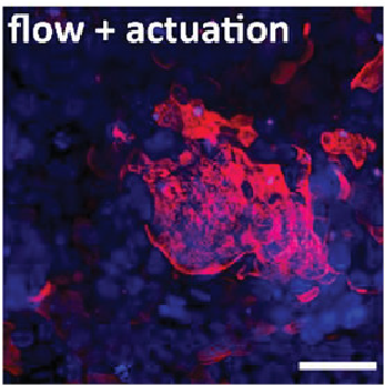 Immunofluorescent image of gut cells grown on an organ-on-a-chip