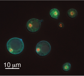 Microscopic image of large titan cells compared to smaller yeast cells