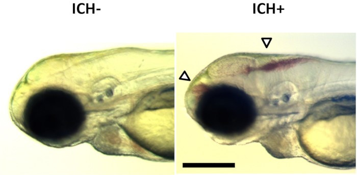 A zebrafish larvae with visible bleeding in the brain to model haemorrhagic stroke.