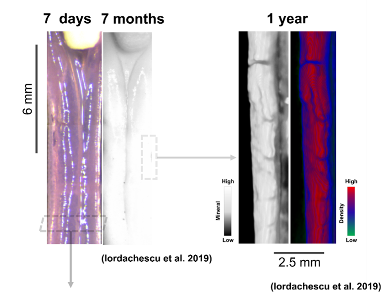 Constructs evolve from composite fibrin-ceramic matrices to heavily mineralised, heterogenous matrices containing the mature bone cell, the osteocyte, over 1 year of culture