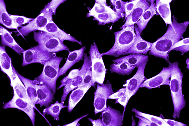 Microscope image of cells glowing purple