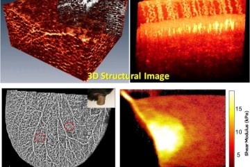 Four 3D structual images of tissue of tissue imaging with functional optical coherence tomography