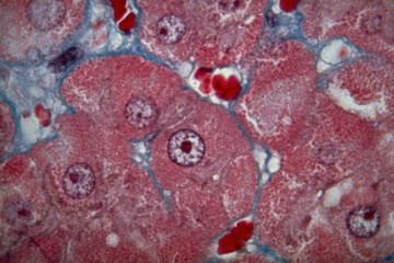 Hepatocytes under a microscope