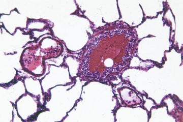Human renal cell line in a perfused titerplate