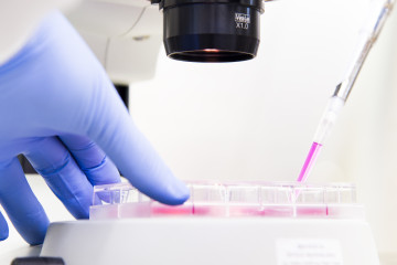 A cell culture plate containing pink liquid under a microscope. A gloved hand is holding the plate while another is pipetting liquid into it.